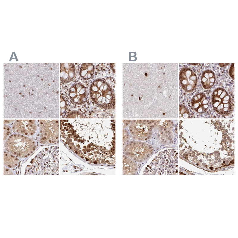 Anti-PSMD7 Antibody