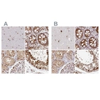 Anti-PSMD7 Antibody