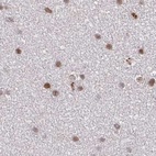 Anti-PSMD7 Antibody