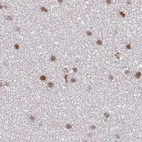 Immunohistochemical staining of human cerebral cortex using Anti-PSMD7 antibody HPA056069.