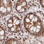 Immunohistochemical staining of human colon using Anti-PSMD7 antibody HPA056069.