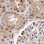 Anti-PSMD7 Antibody