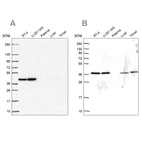 Western blot analysis using Anti-PSMD7 antibody HPA056069 (A) shows similar pattern to independent antibody HPA049824 (B).