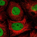 Immunofluorescent staining of human cell line HeLa shows localization to nucleoplasm.