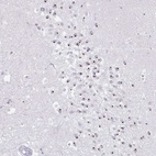 Anti-FAM9A Antibody