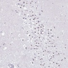 Anti-FAM9A Antibody