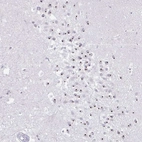 Anti-FAM9A Antibody