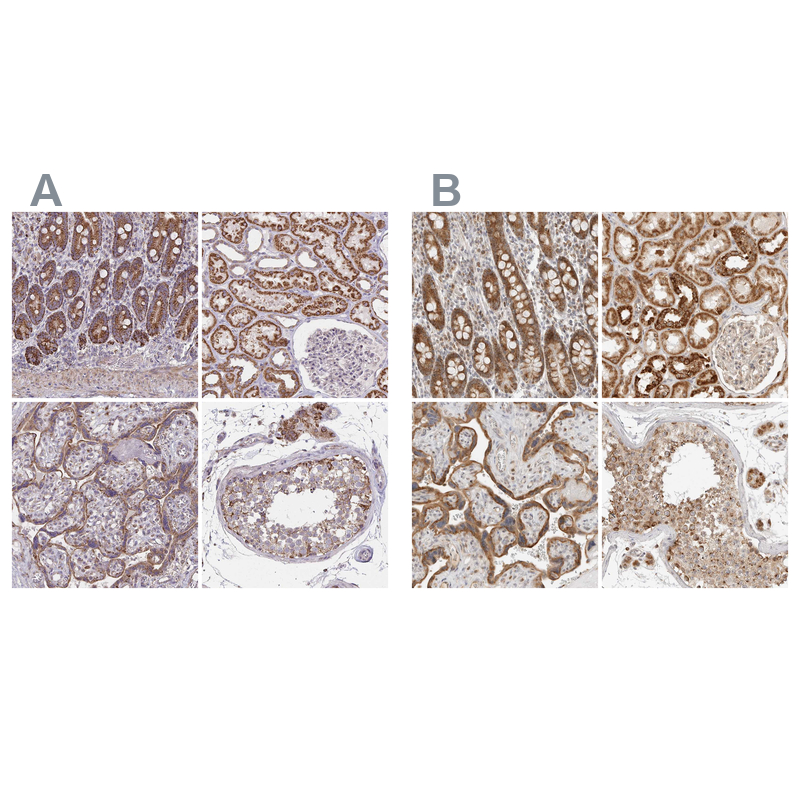 Anti-DYRK4 Antibody