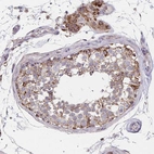 Immunohistochemical staining of human testis shows strong cytoplasmic positivity in cells in seminiferous ducts.