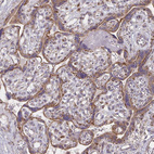 Immunohistochemical staining of human placenta shows strong cytoplasmic positivity in trophoblastic cells.