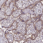 Immunohistochemical staining of human placenta shows strong cytoplasmic positivity in trophoblastic cells.