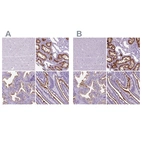 Immunohistochemical staining of human cerebral cortex, kidney, prostate and small intestine using Anti-MME antibody HPA056072 (A) shows similar protein distribution across tissues to independent antibody HPA052583 (B).