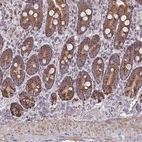 Immunohistochemical staining of human duodenum shows strong cytoplasmic positivity in glandular cells.