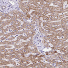 Anti-MPC2 Antibody