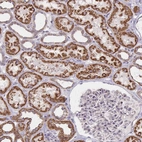 Immunohistochemical staining of human kidney shows strong cytoplasmic positivity in cells in tubules.