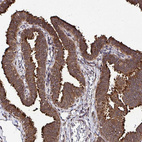 Anti-FMR1 Antibody