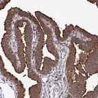Immunohistochemical staining of human Fallopian tube shows strong cytoplasmic and membranous positivity in glandular cells.