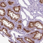 Immunohistochemical staining of human kidney shows strong membranous positivity in cells in tubules.
