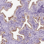 Immunohistochemical staining of human prostate shows strong membranous positivity in glandular cells.