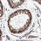 Immunohistochemical staining of human Testis shows strong cytoplasmic positivity in spermatogonia.