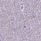 Anti-MPC2 Antibody