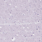Immunohistochemical staining of human cerebral cortex shows no positivity in neurons as expected.