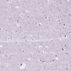 Immunohistochemical staining of human cerebral cortex shows no positivity in neurons as expected.