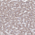 Anti-FMR1 Antibody