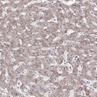 Immunohistochemical staining of human Liver shows weak cytoplasmic positivity in hepatocytes.