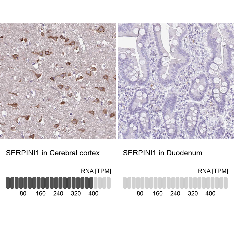 Anti-SERPINI1 Antibody