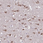 Anti-SERPINI1 Antibody