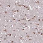 Immunohistochemical staining of human cerebral cortex shows high expression.