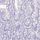 Immunohistochemical staining of human duodenum shows low expression as expected.
