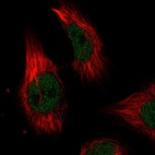 Anti-ILKAP Antibody