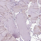 Immunohistochemical staining of human skeletal muscle shows low expression as expected.