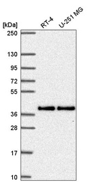 Anti-MTFR1 Antibody