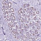 Immunohistochemical staining of human breast shows high expression.