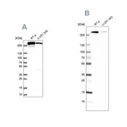 Western blot analysis using Anti-FASN antibody HPA056108 (A) shows similar pattern to independent antibody HPA006461 (B).