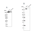 Western blot analysis using Anti-FASN antibody HPA056108 (A) shows similar pattern to independent antibody HPA006461 (B).