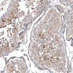 Immunohistochemical staining of human testis shows moderate membranous positivity in cells in seminiferous ducts.