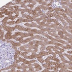 Anti-MSMO1 Antibody