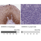 Anti-SOWAHC Antibody