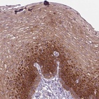 Immunohistochemical staining of human esophagus shows high expression.