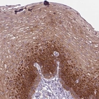 Immunohistochemical staining of human esophagus shows high expression.