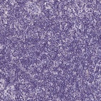 Anti-SOWAHC Antibody