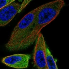 Immunofluorescent staining of human cell line PC-3 shows localization to cytosol.