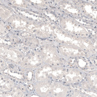 Anti-CD99 Antibody