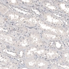 Immunohistochemical staining of human kidney shows no positivity in cells in tubules as expected.
