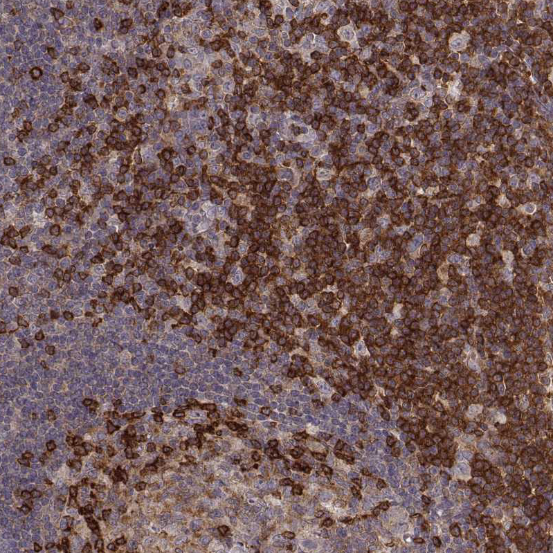 Anti-PILRA Antibody