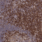 Anti-PILRA Antibody